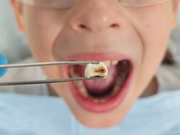 Best Weekend Emergency Dentist in Fountain Green, UT