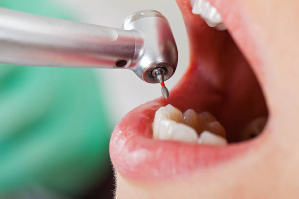 Best Emergency Broken Tooth Repair in Fountain Green, UT